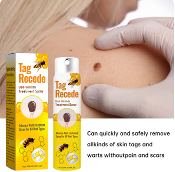 Skin Tag Removal Cream - Wart Removal Cream - Skin Mole Remover Spray Price in Pakistan