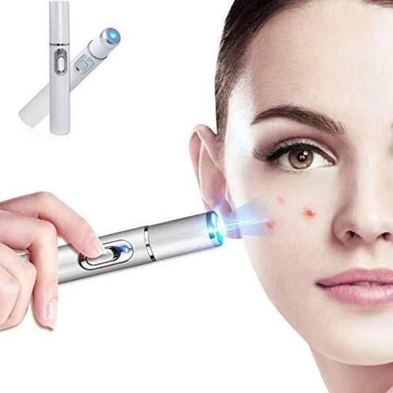 Blue Light Acne Removing Pen - Multi-Function Skincare Device for Acne - Varicose Veins - Scars and Wrinkles - Blue Light Acne Removing Pen Price in Pakistan