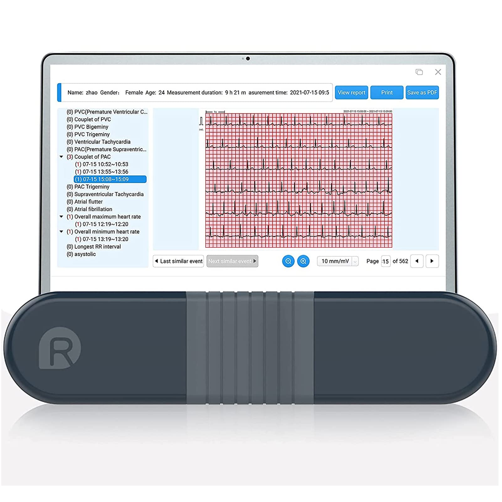 AI Holter ECG/EKG Monitoring Bluetooth  - price in Pakistan