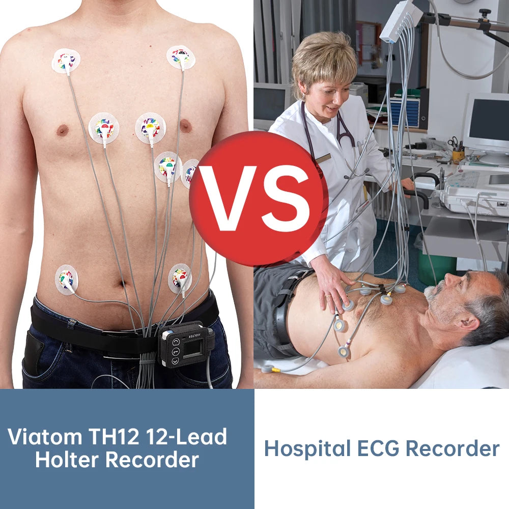 AI Holter ECG/EKG Monitoring Bluetooth  - price in Pakistan