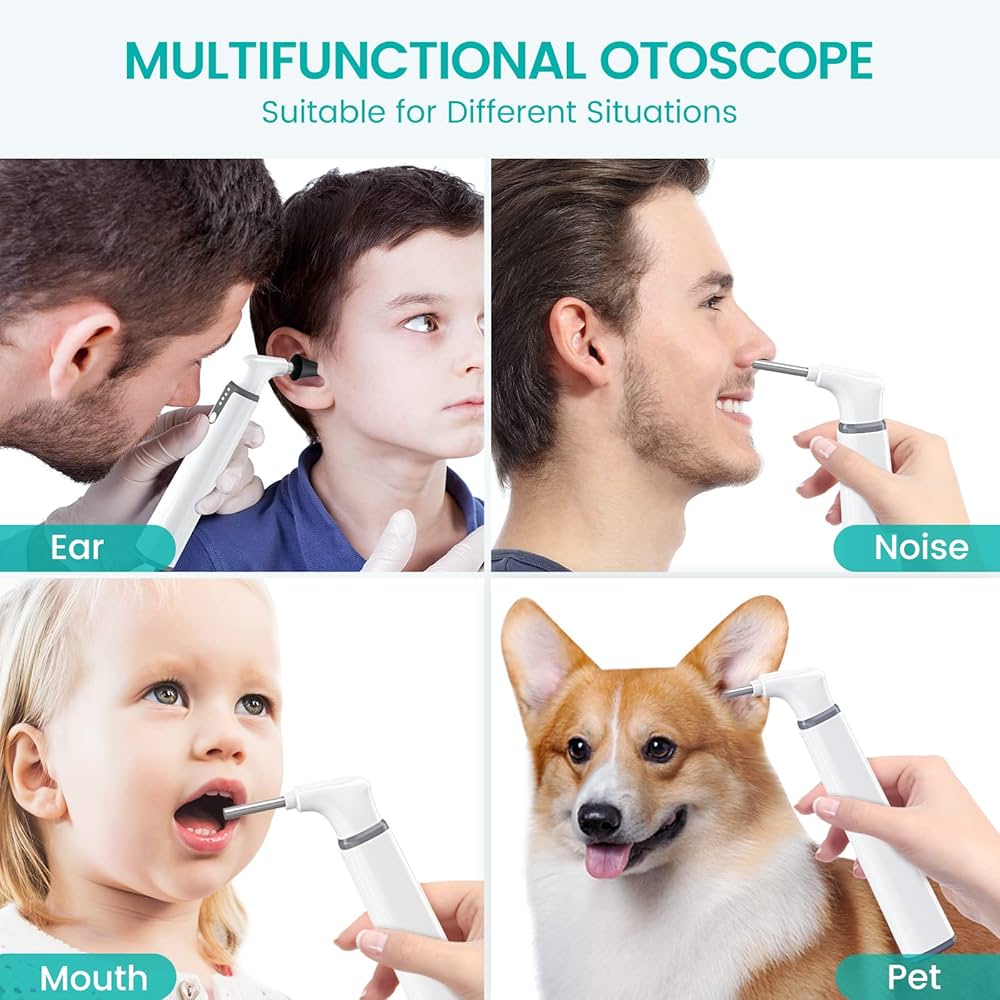 Digital Wireless EAR Otoscope with 3.9mm Camera 1080P HD - WiFi Ear Otoscope with 6 LED Lights for Kids and Adults - Digital Otoscopes in Pakistan