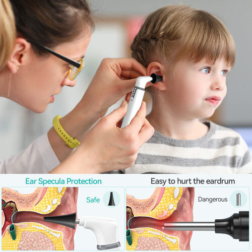 Digital Wireless EAR Otoscope with 3.9mm Camera 1080P HD - WiFi Ear Otoscope with 6 LED Lights for Kids and Adults - Digital Otoscopes in Pakistan