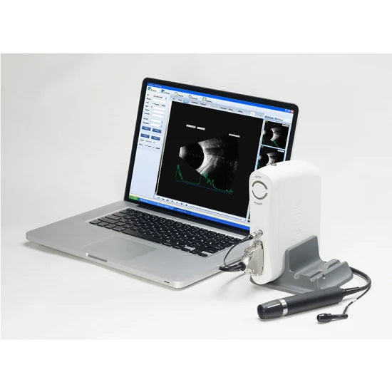 Ophthalmology A-B Scanner - SW-2100 Portable Customized to Laptop Ophthalmic Ultrasound Scan Machine -  One B Scan with USB Port - Ophthalmology A-B Scanner Price in Pakistan