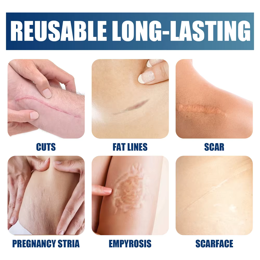 Silicone Scar Removal Cream Gel Burn Surgical Scar Cesarean Repairing Stretch Marks Whitening Pigmentation Corrector - Silicone Scar Removal Gel in Pakistan - Scar Removal Cream Supplies