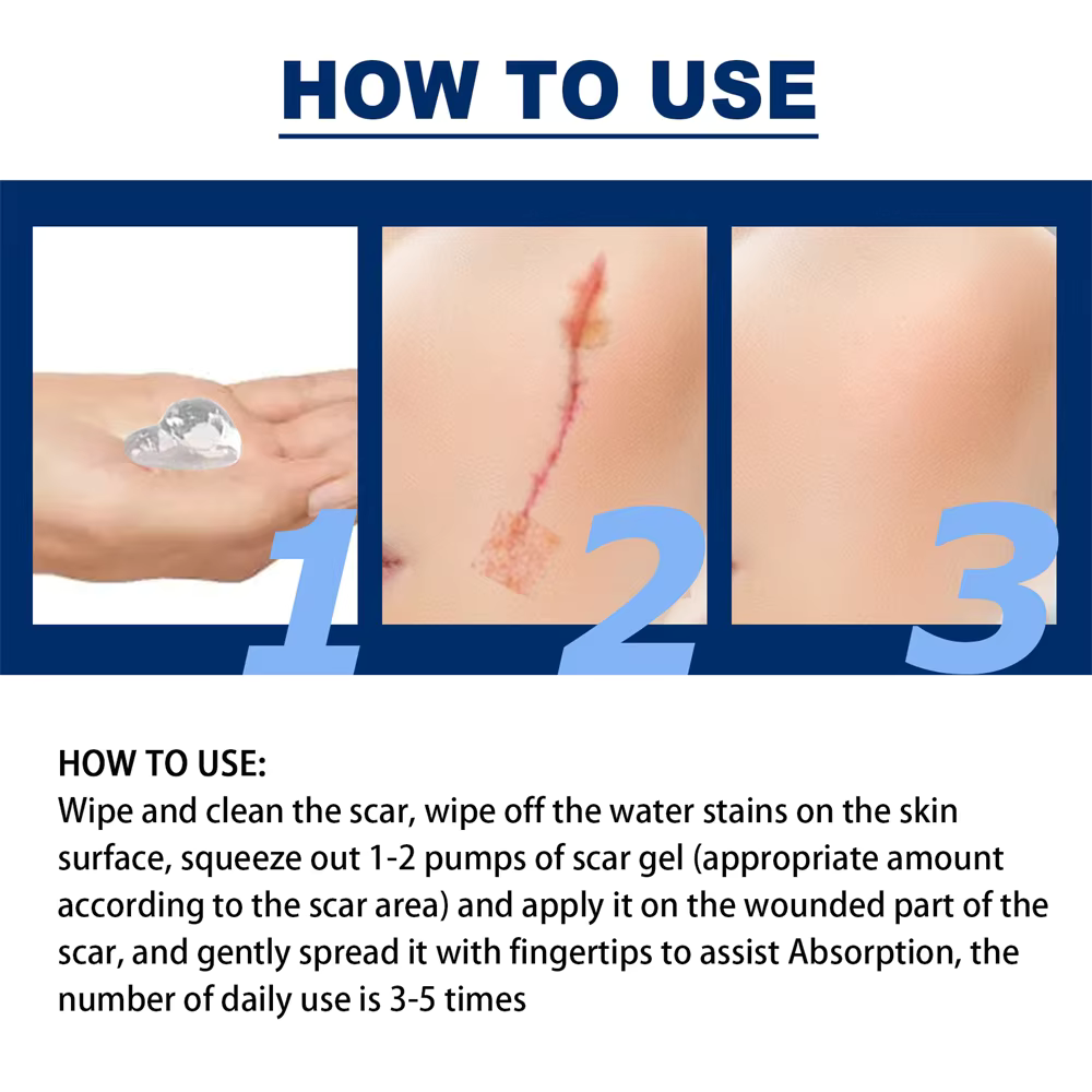 Silicone Scar Removal Cream Gel Burn Surgical Scar Cesarean Repairing Stretch Marks Whitening Pigmentation Corrector - Silicone Scar Removal Gel in Pakistan - Scar Removal Cream Supplies