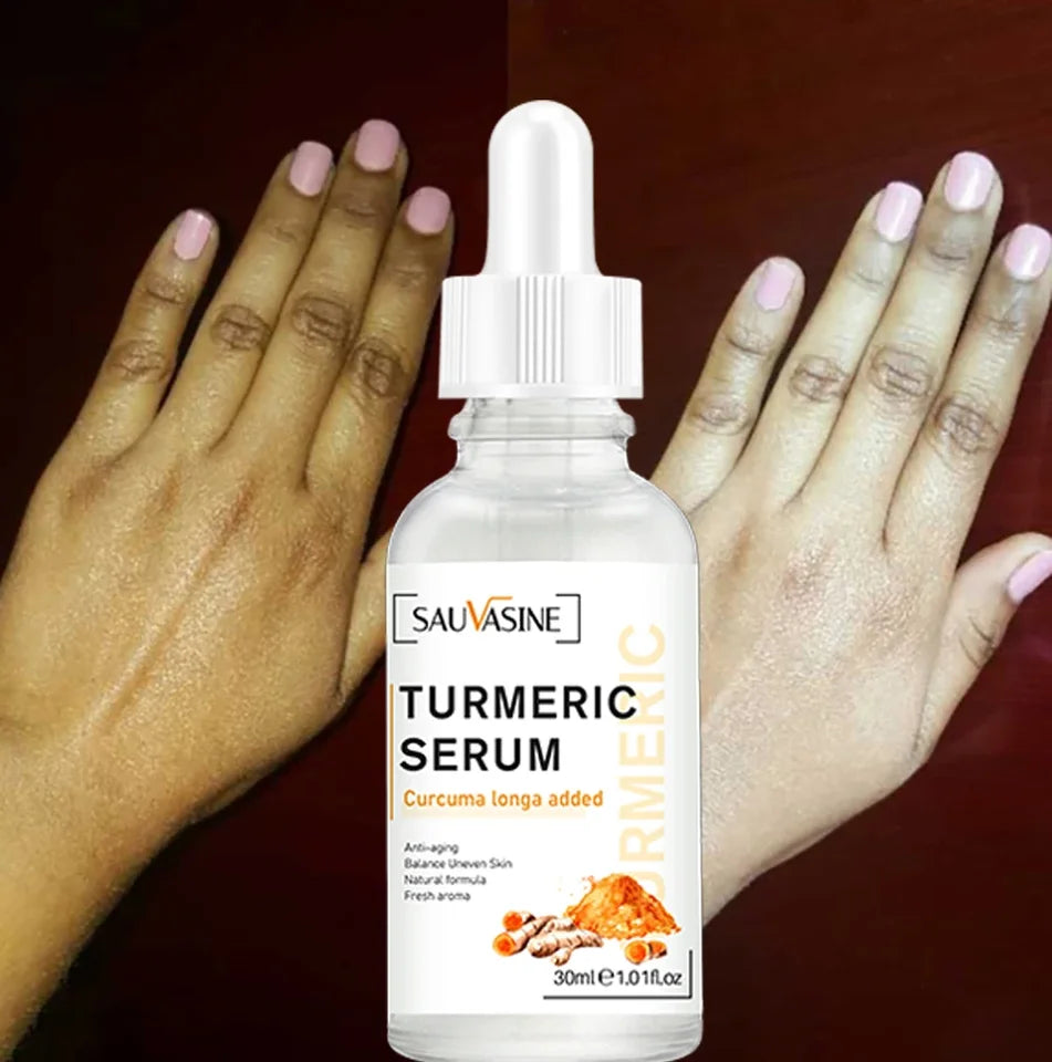 Turmeric Face Whitening Serum – Your Path to Radiant, Youthful Skin - Turmeric Face Whitening Serum Price in Pakistan