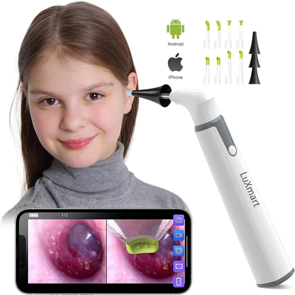 Wireless Otoscope Ear Camera 3.9mm 1080P HD Wi-Fi Ear Scope - Wireless Otoscope Ear Camera Price in Pakistan